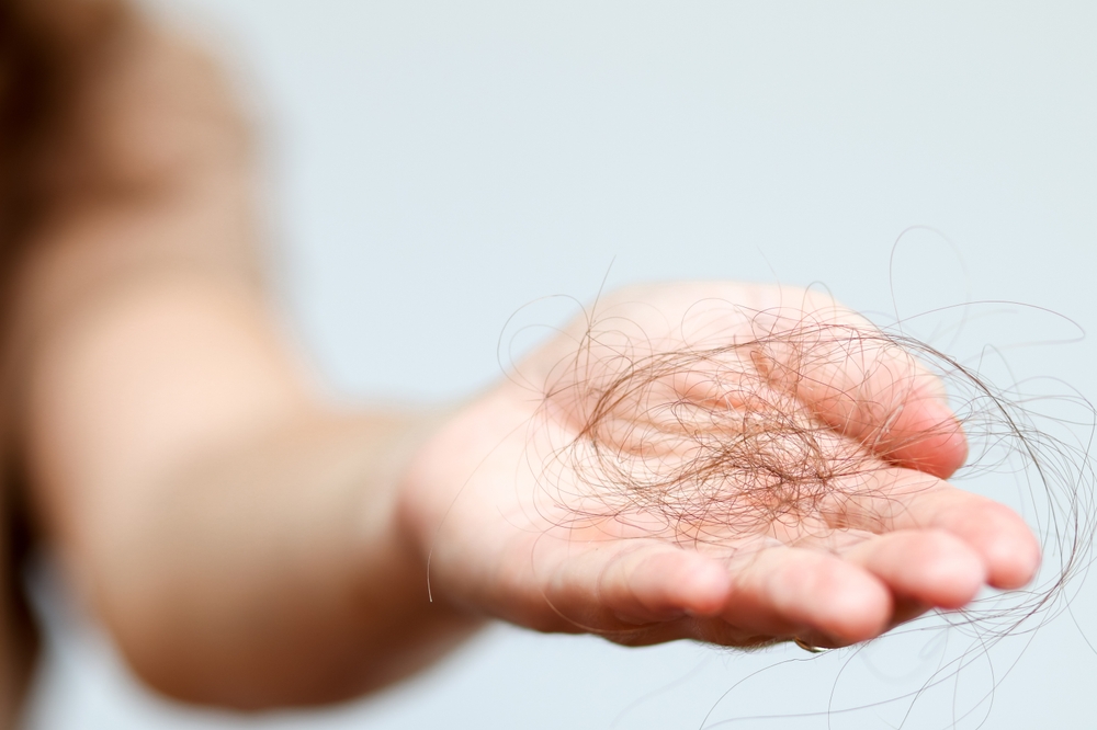Why Is My Hair Falling Out Glasgow